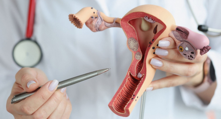 Image representing Fact or Fiction: Understanding PCOS