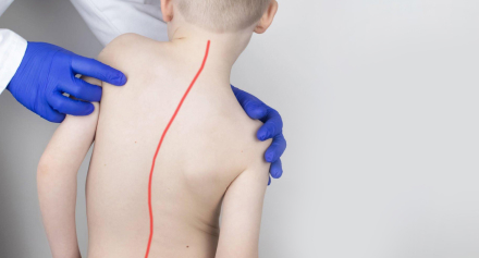 Image representing A Parent’s Guide to Scoliosis in Children: Managing and Supporting Your Child
