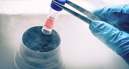 Image representing From Decision to Procedure: How to Fully Prepare Yourself for Egg Freezing in Malaysia