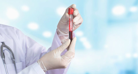 Image representing CAR T-Cell Therapy Explained: Benefits, Risks, and What to Expect